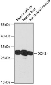 DOK5 Rabbit pAb