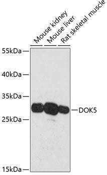 DOK5 Rabbit pAb