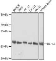 UCHL3 Rabbit mAb