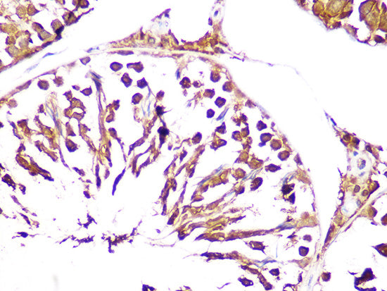 UCHL3 Rabbit mAb