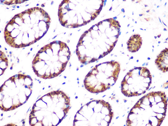 UCHL3 Rabbit mAb