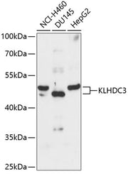 KLHDC3 Rabbit pAb
