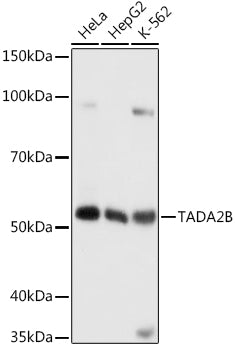 TADA2B Rabbit pAb
