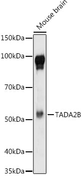 TADA2B Rabbit pAb