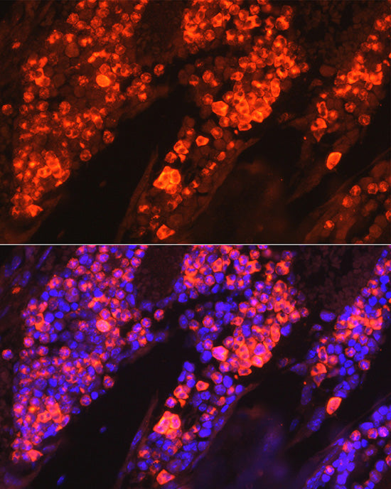 Myeloperoxidase (MPO) Rabbit pAb