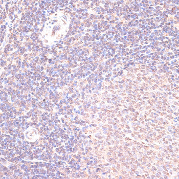 HSF1 Rabbit pAb