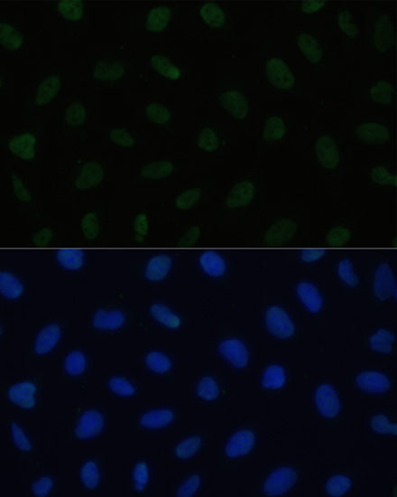 HSF1 Rabbit pAb