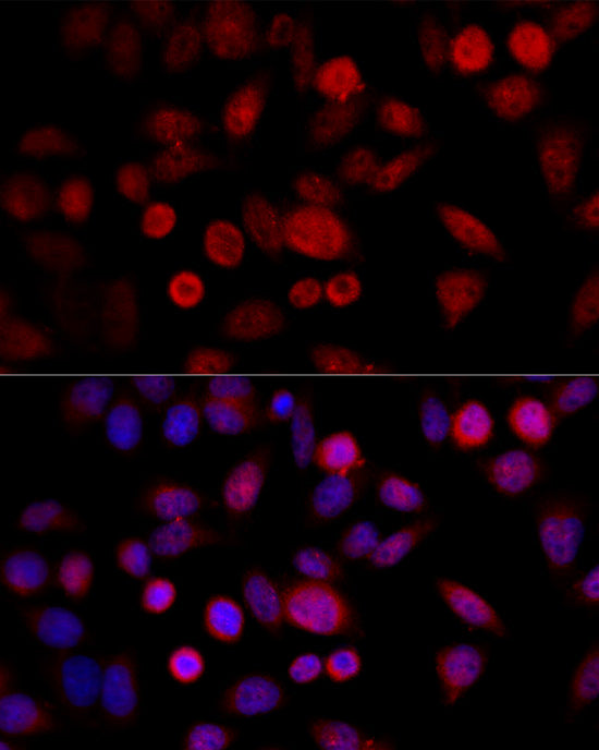 CYP1B1 Rabbit pAb
