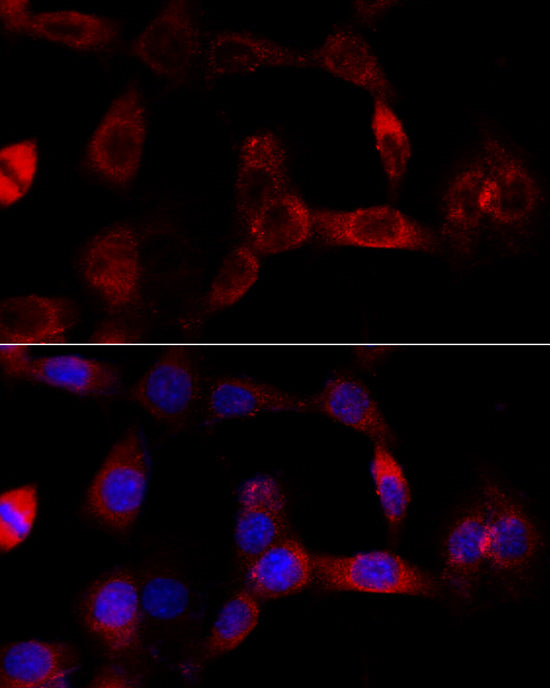 CYP1B1 Rabbit pAb