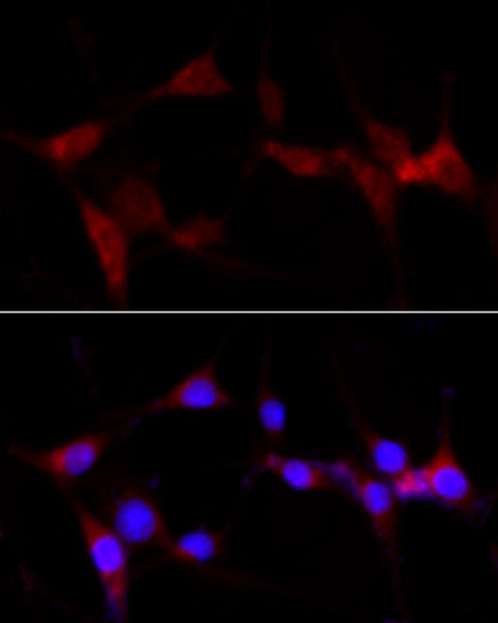 CYP1B1 Rabbit pAb