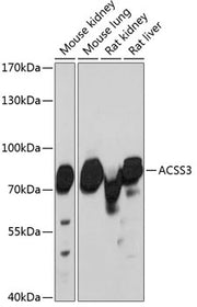 ACSS3 Rabbit pAb
