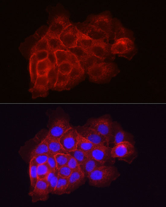 Coagulation factor III/Tissue Factor Rabbit pAb