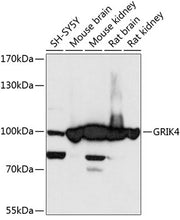 GRIK4 Rabbit pAb