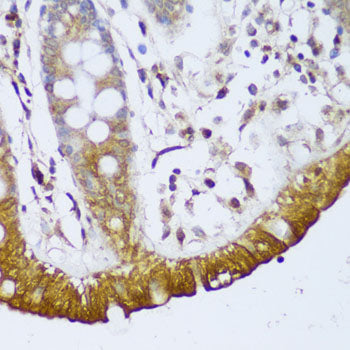 GCC2 Rabbit pAb
