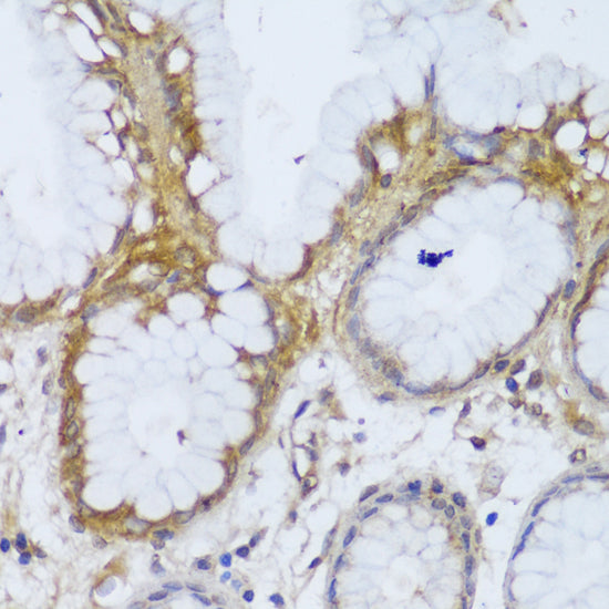 GCC2 Rabbit pAb
