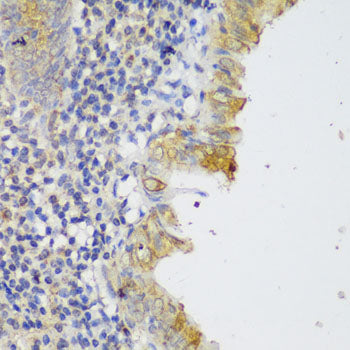 GCC2 Rabbit pAb