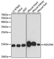 [KO Validated] NDUFB4 Rabbit pAb