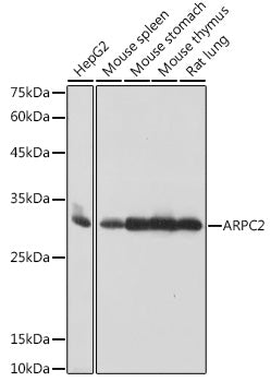 ARPC2 Rabbit mAb