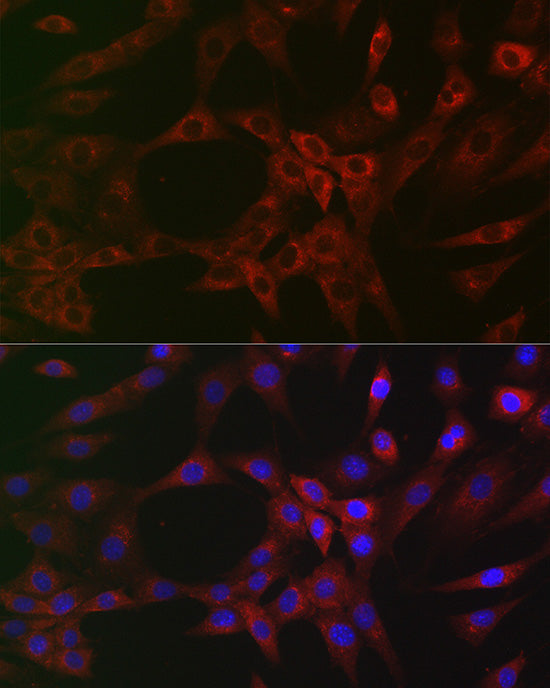 ARPC2 Rabbit mAb