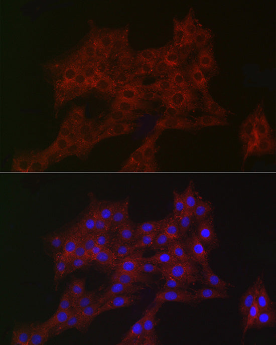 ARPC2 Rabbit mAb