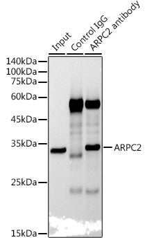 ARPC2 Rabbit mAb