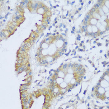 CRACR2A Rabbit pAb
