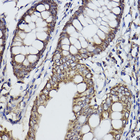 Fukutin Rabbit mAb