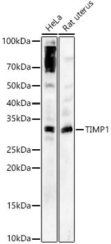TIMP1 Rabbit pAb