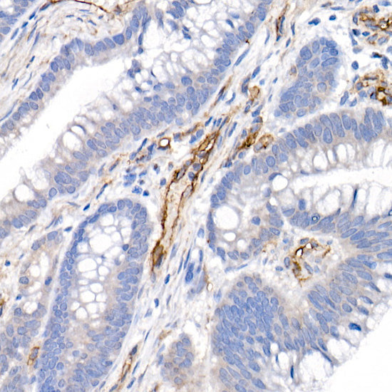 CD146/MCAM Rabbit pAb