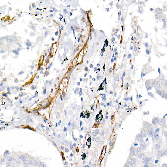 CD146/MCAM Rabbit pAb
