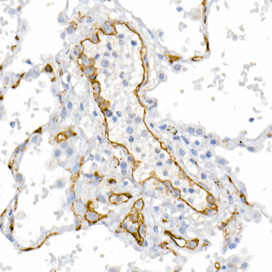 CD146/MCAM Rabbit pAb