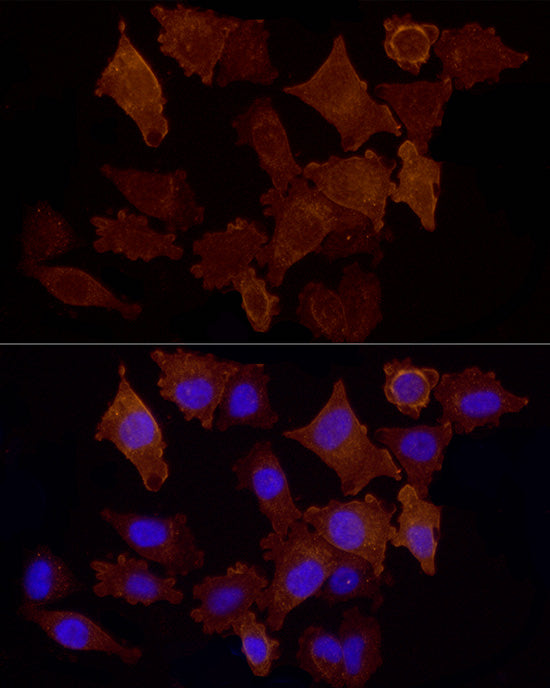 CD146/MCAM Rabbit pAb