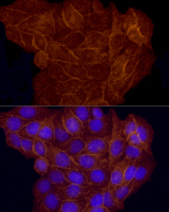 CD146/MCAM Rabbit pAb
