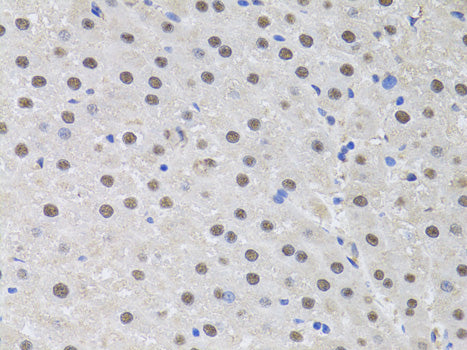 HUS1 Rabbit pAb