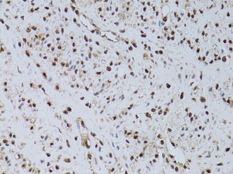 HUS1 Rabbit pAb