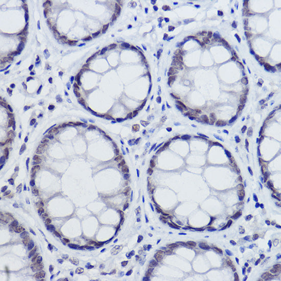 USP39 Rabbit mAb