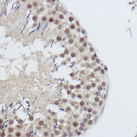 USP39 Rabbit mAb