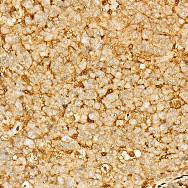 Annexin A5/Annexin V Rabbit pAb
