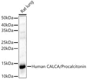 CALCA Rabbit pAb