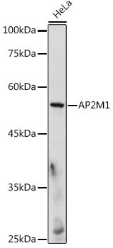 AP2M1 Rabbit pAb