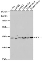 ACAT2 Rabbit mAb