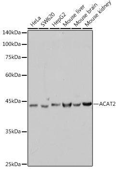 ACAT2 Rabbit mAb