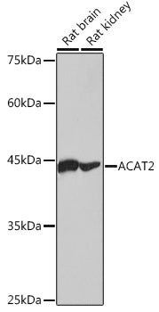 ACAT2 Rabbit mAb