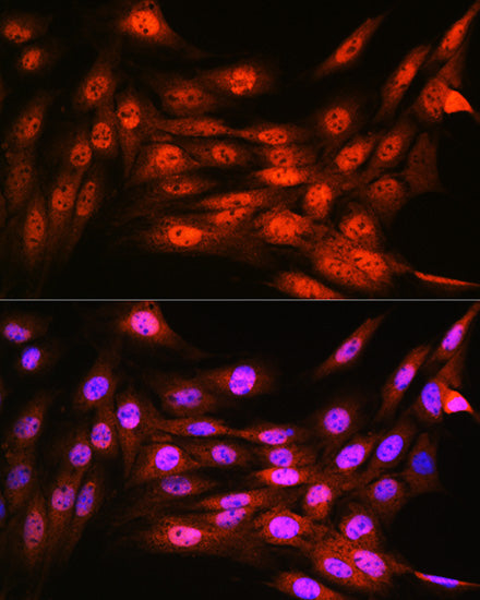 VCP Rabbit mAb