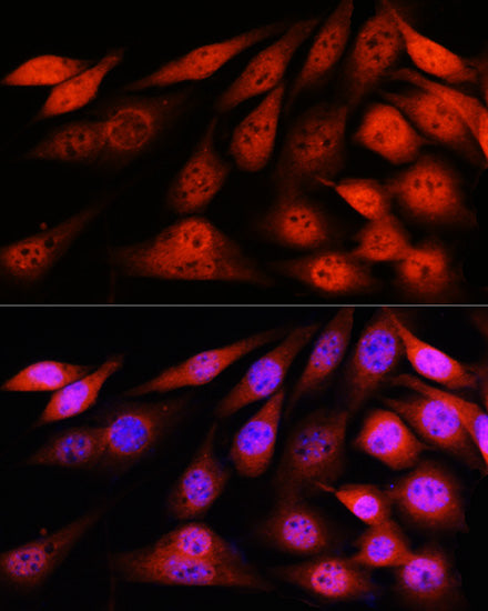 VCP Rabbit mAb