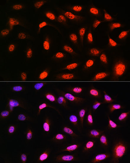 VCP Rabbit mAb
