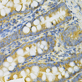 PGK1 Rabbit pAb