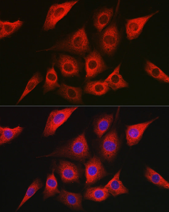 AMPKα2 Rabbit pAb