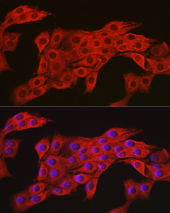 AMPKα2 Rabbit pAb