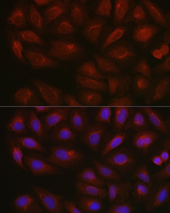 AMPKα2 Rabbit pAb